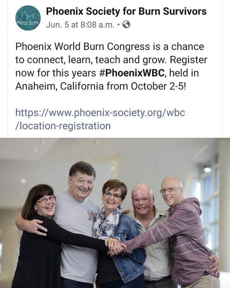 Phoenix Society World Burn Conference Calgary Firefighters Burn